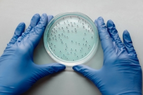 NTM Tespiti İçin CRISPR Tabanlı Yenilikçi Yöntem Geliştirildi