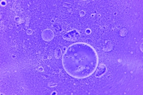 RNA Damlacıkları Mutasyon ile Gelişiyor